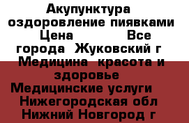 Акупунктура, оздоровление пиявками › Цена ­ 3 000 - Все города, Жуковский г. Медицина, красота и здоровье » Медицинские услуги   . Нижегородская обл.,Нижний Новгород г.